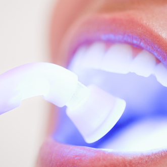 Specials for San Diego's Top Dentist
