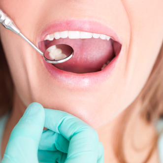 Dental mirror inspecting teeth